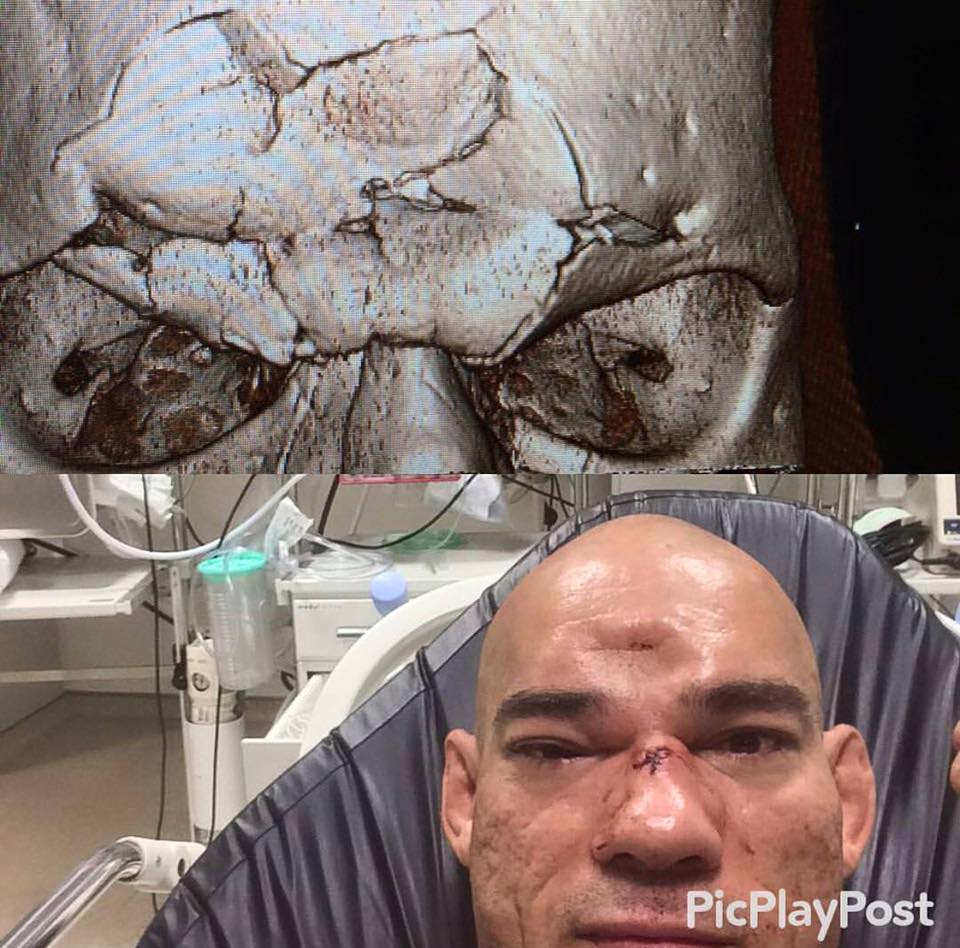 13697140_10154181268875801_1840095207936980934_n