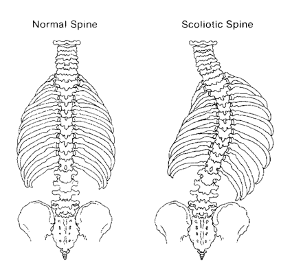 spine[1]