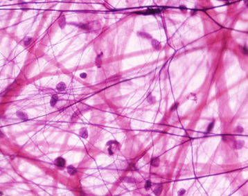 Il tessuto connettivo