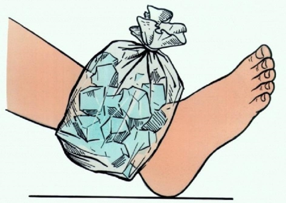 Traumatologia e sport (3/3): tendinopatie, terapie e prevenzione degli&nbsp;infortuni