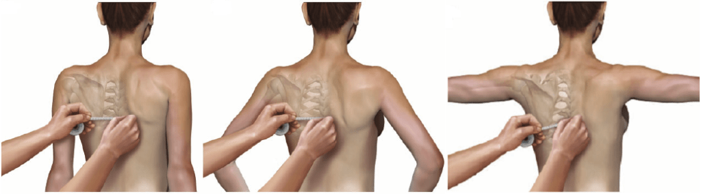 Le asimmetrie nella&nbsp;pallavolo